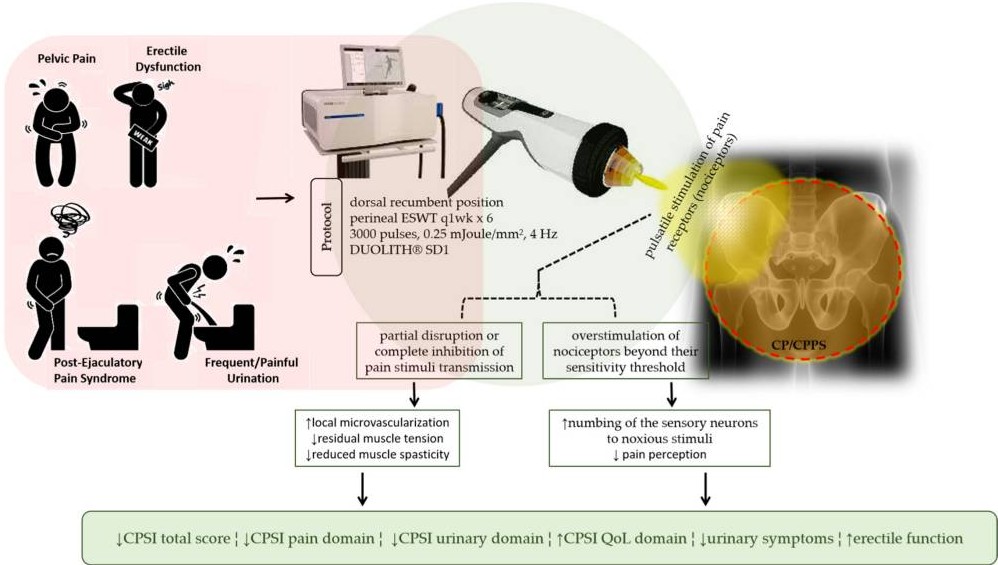 Uitlegdiagram shockwave therapie bij CPPS