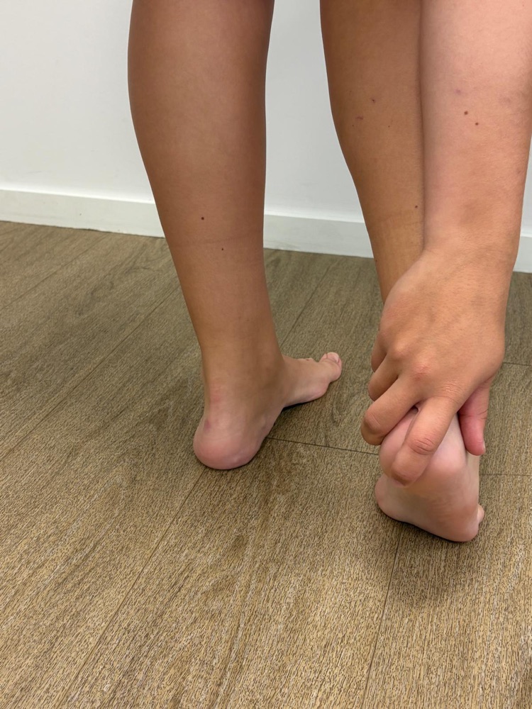 Patiënt houdt haar pijnlijke hiel vast