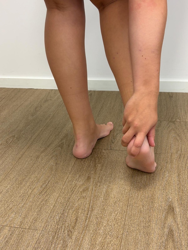 Hielspoor & Fasciitis Plantaris